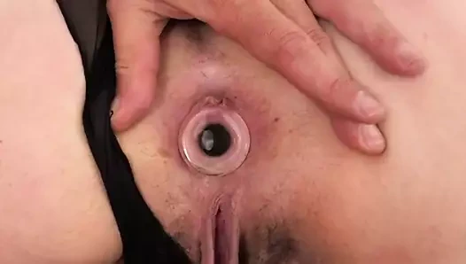 Tıkaç, anal ve boşalma