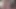 Der asiatischen dicktittigen Schlampe die Mandeln untersucht