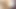 Problemler Üniversitesi - (pt 45) - dreamnow