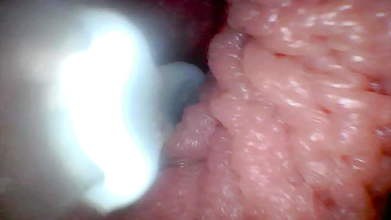 Let's take a peek into my juicy pussy together (endoscope camera)