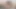 Seksi orta yaşlı seksi kadın Valeria'nın spekulum ile rahim ağzı muayenesi