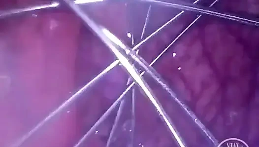 Viski götümü içeriden açıyor