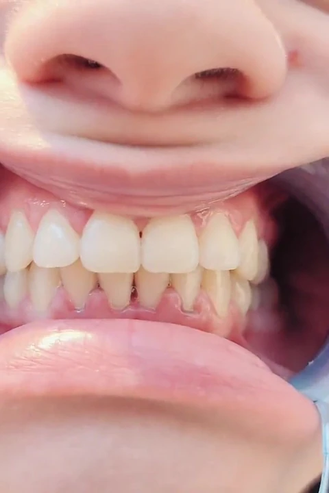 4k diş hijyen uzmanı rutin ağız fetişi yakın çekim çıplak