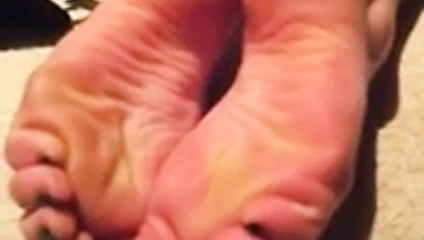 Buruşuk tabanlar ve ayak parmakları gerilir