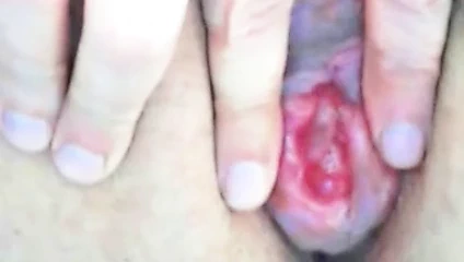 Anal pompalama - elektro pompa