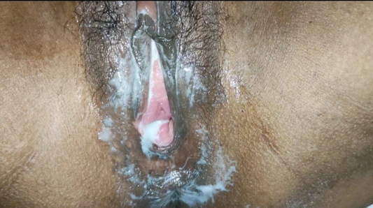 Başından bıçakla iki kez bıçaklanan bir kadın, iki kez bıçaklandı. Bir komşunun karısıyla kıvranıyor.