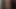 Beni duş alırken izle, iyileştiğini duydum