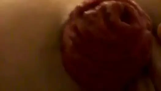 fahişe iterek dışarı onu anal prolapsus