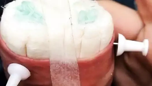 sünnet derisi işkencesi1