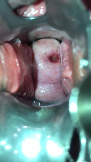 Chinese milf serviks eğitim