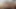 Brazzers - Dr. Monique Alexander yaramaz hemşire Nekane Sweet'e sürtük gibi nasıl davranılası gerektiğini gösteriyor