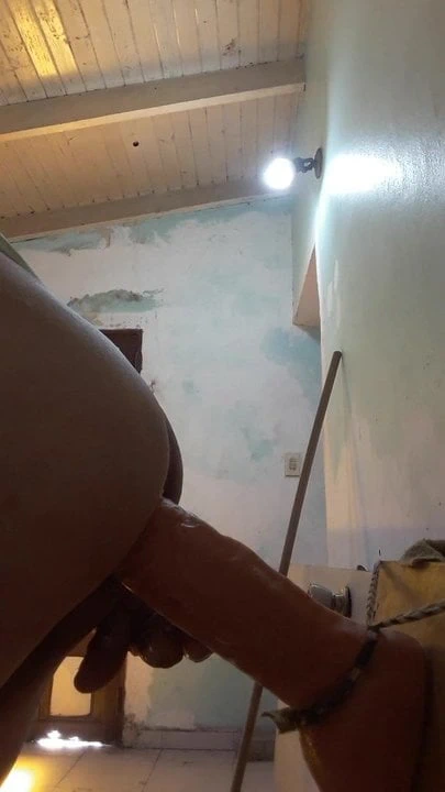 agrandamiento total anal