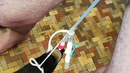 Ağırlıklı kateter sallanıyor