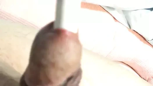 Kalem sesiyle sünnet derisi oyunu ile üretral dilatasyon