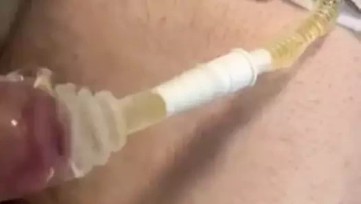 Engelli bebek bezi çiş belden aşağısı felçli