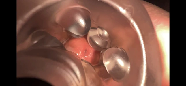 Fleshlight'ta boşalma (ağır çekim)