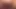 teen kullanımları yapay penis