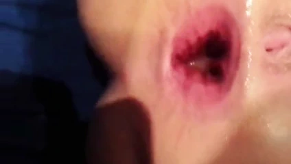 Delik genişletme götü