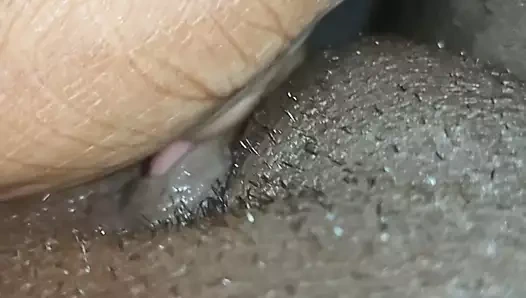 parmak sonra sağladım