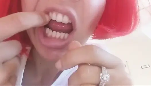 Chantal'ın dişleri çürümüş ve siyah dökülüyor