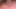 I Am Having Anal Sex for the First Time in My 71years of Age.