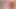 Penis ölçme 04