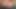 Dev redbone 42j macromastia titties