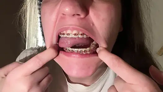 Dilinizle diş teli yalamak