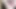 Endoskopi!! Giantess aynı anda 25 üyeyi yuttu