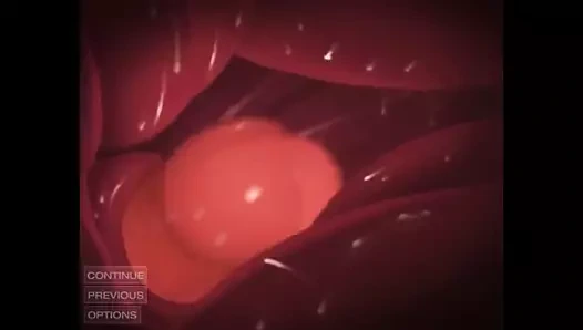 Zero suit samus vs. charizard