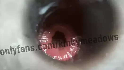 Delikli anal tıkaç eğitimi