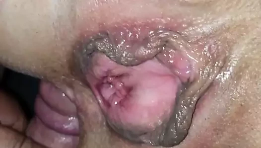 patron otel doldurma