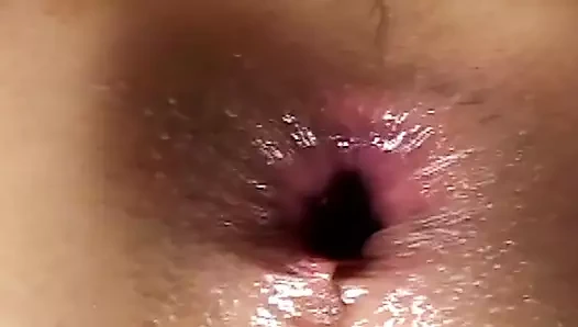 Yoğun bağda erkek delisi ateşi