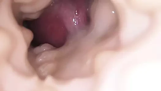 Dölleme içgörüsü Fleshligh