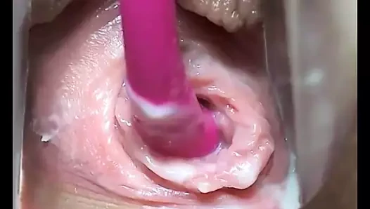 Yakın ve kişisel sulu vajina