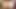 GAPING ASSHOLE by ZUCCHINI Trailer (Amateur, Hairy, Teen, Gape, Farts, Homemade, Wet Pussy, Farting)