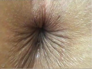 Popo deliği göz kırparak kapatın