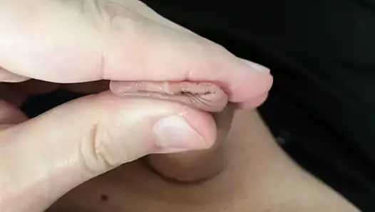 Küçük forskin penis