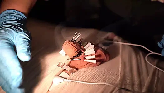 Tıbbi oyun eğlencesi, mumyalama, iğne cbt ve elektro