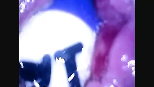 Götümün içindeki havuz taşakları