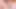 Extreme anal transvestite (psykoanal)