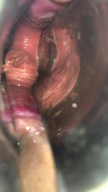 Куско к аналу