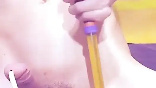 İdrar kesesinde şişme 900 ml!