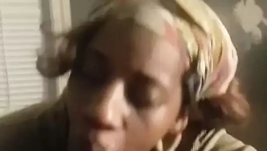 büyükanne diş etleri