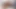 Bu insan kırkayak mı yoksa 3 başlı bir canavar mı?