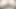 Anal Üvey Kız Bölüm 1