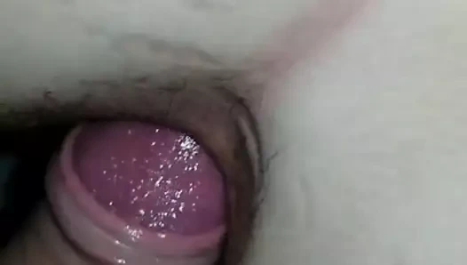 gapped asshole