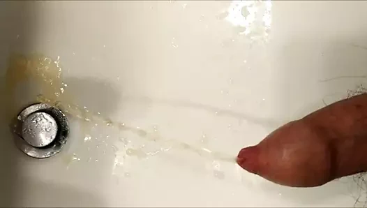 Sıkı sünnet derimden işemek (fimozis)