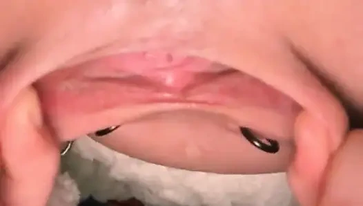 Köle S Labiasını Dikiyor