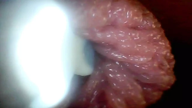 Endoskop kamera penis eğitim videosunda en hassas kısımlarını gösteriyor
